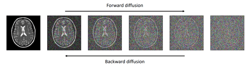 mri_diffusion